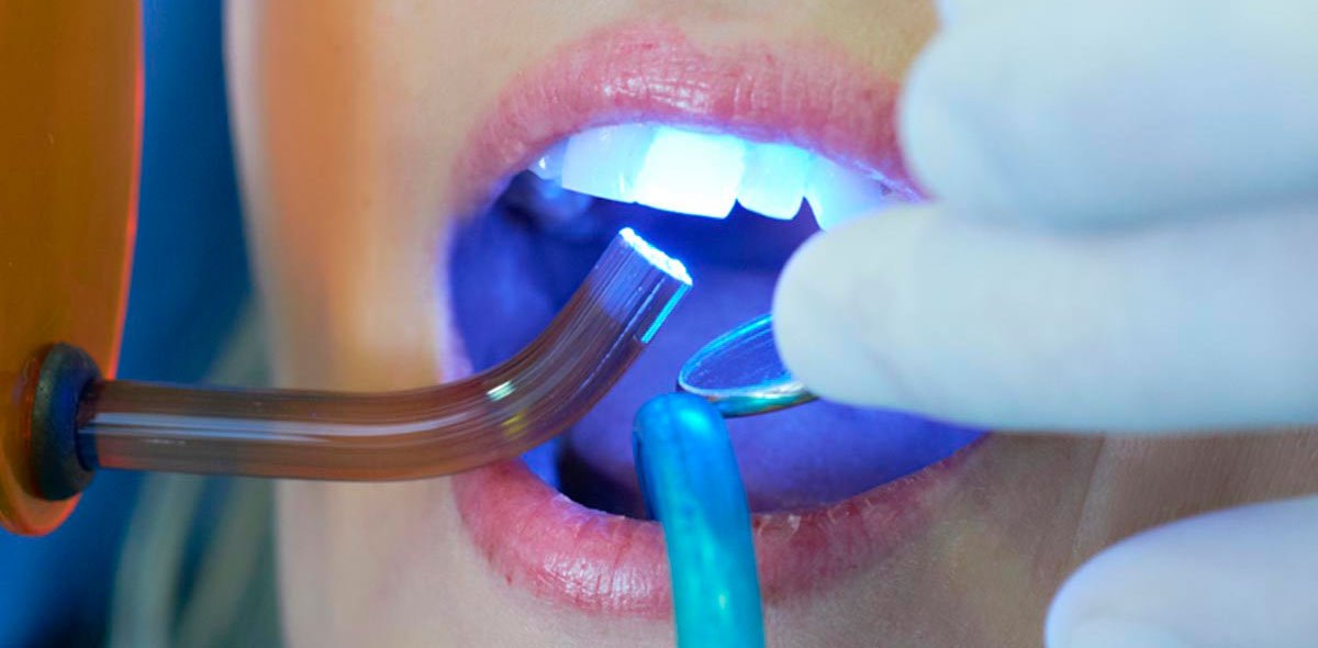 applicazioni laser